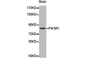 Western Blotting (WB) image for anti-Phosphoinositide 3 Kinase, p85 alpha (PI3K p85a) antibody (ABIN1874135) (PIK3R1 抗体)