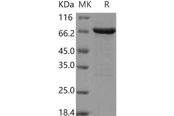 FGFR2 Protein (AA 400-821) (GST tag,His tag)