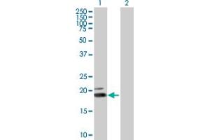 Western Blot analysis of IFNW1 expression in transfected 293T cell line by IFNW1 MaxPab polyclonal antibody. (IFNW1 抗体  (AA 1-195))