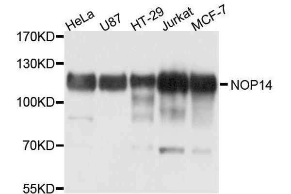 Nop14 抗体  (AA 1-240)