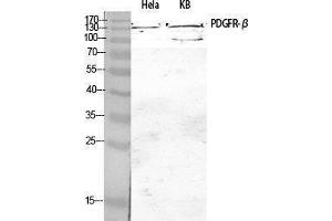 Western Blotting (WB) image for anti-Platelet Derived Growth Factor Receptor beta (PDGFRB) (Thr215) antibody (ABIN3186370) (PDGFRB 抗体  (Thr215))