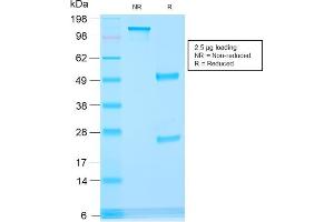 SDS-PAGE (SDS) image for anti-alpha-Methylacyl-CoA Racemase (AMACR) (AA 297-394) antibody (ABIN6939429)