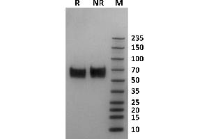 Human Fc gamma RI / CD64 protein on Coomassie Blue stained SDS-PAGE under non-reducing (NR) and reducing (R) conditions. (FCGR1A Protein (AA 16-281) (His-Avi Tag))