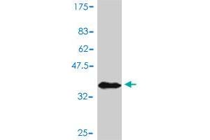 Western Blot detection against Immunogen (37. (AKT1 抗体  (AA 381-480))