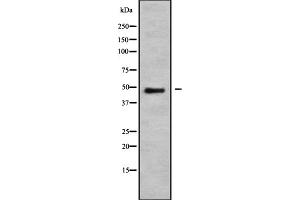 Western blot analysis NMUR1 using K562 whole cell lysates. (NMUR1 抗体)