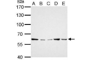 WB Image GGT1 antibody detects GGT1 protein by Western blot analysis. (GGT1 抗体)