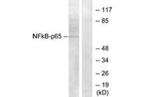 Western Blotting (WB) image for anti-Nuclear Factor-kB p65 (NFkBP65) (AA 221-270) antibody (ABIN2889039) (NF-kB p65 抗体  (AA 221-270))
