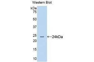 Detection of Recombinant AGR2, Human using Monoclonal Antibody to Anterior Gradient 2 (AGR2) (AGR2 抗体  (AA 21-175))