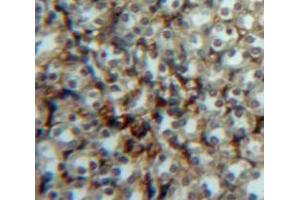 Used in DAB staining on fromalin fixed paraffin-embedded Kidney tissue (p53 抗体  (AA 108-370))