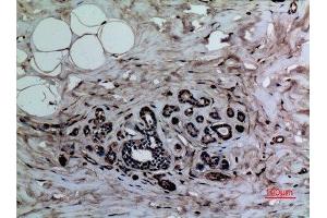 Immunohistochemistry (IHC) analysis of paraffin-embedded Human Breast, antibody was diluted at 1:100. (Histone 3 抗体  (meLys37))