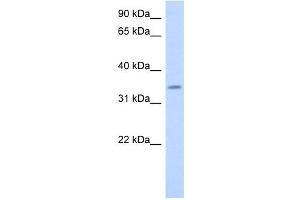 PAQR6 antibody used at 1 ug/ml to detect target protein. (PAQR6 抗体  (Middle Region))