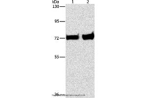 Western blot analysis of Mouse liver and kidney tissue, using PCK1 Polyclonal Antibody at dilution of 1:375 (PCK1 抗体)