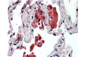 IHC staining of FFPE human lung with IDE antibody at 2. (IDE 抗体)