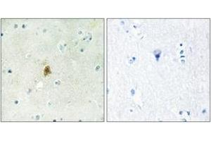 Immunohistochemistry analysis of paraffin-embedded human brain tissue, using TAF15 Antibody. (TAF15 抗体  (AA 351-400))