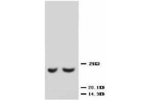 Image no. 1 for anti-Metalloproteinase Inhibitor 2 (TIMP2) (C-Term) antibody (ABIN1493035) (TIMP2 抗体  (C-Term))