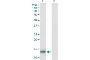 Western Blot analysis of IL2 expression in transfected 293T cell line by IL2 monoclonal antibody (M11), clone 1C5. (IL-2 抗体  (AA 21-153))