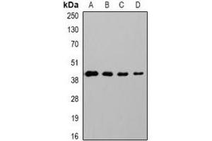 Western blot analysis of GAP43 expression in Hela (A), 293T (B), mouse brain (C), rat brain (D) whole cell lysates. (GAP43 抗体)