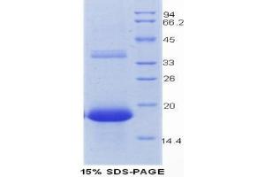 SDS-PAGE analysis of Mouse REG3G Protein. (REG3g 蛋白)