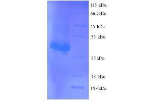 SDS-PAGE (SDS) image for Integrin Alpha2b (CD41) (AA 639-887) protein (His tag) (ABIN5713566) (Integrin Alpha2b Protein (CD41) (AA 639-887) (His tag))