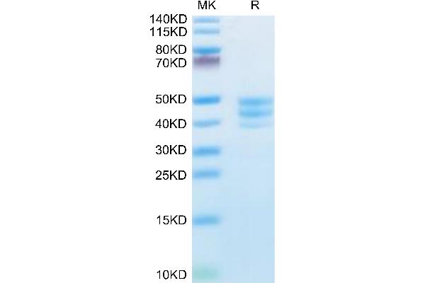 PSCA Protein (AA 12-86) (Fc Tag)