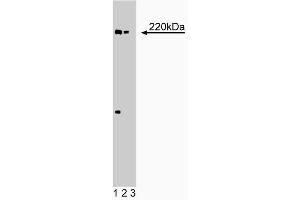 Western blot analysis of eIF-4gamma on EB-1 lysate. (eIF-4gamma (AA 1217-1386) 抗体)