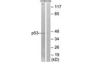 Western Blotting (WB) image for anti-Tumor Protein P53 (TP53) (AA 8-57) antibody (ABIN2889048) (p53 抗体  (AA 8-57))