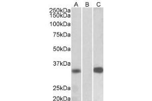 Western Blotting (WB) image for anti-Kv Channel Interacting Protein 3, Calsenilin (KCNIP3) (Internal Region) antibody (ABIN2465100) (DREAM 抗体  (Internal Region))