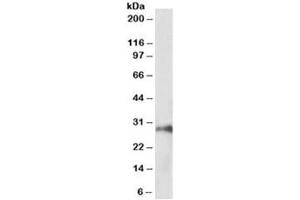 Western blot testing of pig kidney lysate with HOXA5 antibody at 1ug/ml. (HOXA5 抗体)