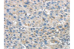 Immunohistochemistry (IHC) image for anti-IQ Motif Containing GTPase Activating Protein 2 (IQGAP2) antibody (ABIN5956954) (IQGAP2 抗体)