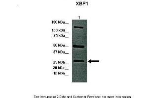 Lanes:   Lane 1: 40ug whole canine retina  Primary Antibody Dilution:   1:1000  Secondary Antibody:   Anti-rabbit-HRP  Secondary Antibody Dilution:   1:5000  Gene Name:   XBP1 a  Submitted by:   Dr. (XBP1 抗体  (C-Term))