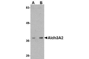 Image no. 1 for anti-Aldehyde Dehydrogenase 3 Family, Member A2 (ALDH3A2) (C-Term) antibody (ABIN342713) (ALDH3A2 抗体  (C-Term))