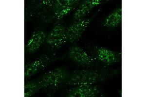 Immunofluorescence (IF) image for anti-Sorting Nexin 1 (SNX1) antibody (ABIN5877304) (Sorting Nexin 1 抗体)