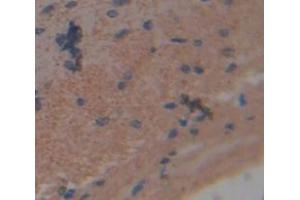 IHC-P analysis of brain tissue, with DAB staining. (NCDN 抗体  (AA 2-300))