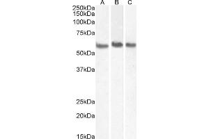 Western Blotting (WB) image for anti-Coronin, Actin Binding Protein, 1A (CORO1A) (C-Term) antibody (ABIN185063)