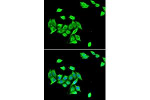 Immunofluorescence analysis of A549 cells using DNMT3A antibody (ABIN5973891). (DNMT3A 抗体)