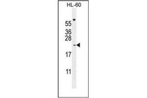 Western blot analysis of PLA2G2C Antibody (C-term) in HL-60 cell line lysates (35ug/lane). (PLA2G2C 抗体  (C-Term))