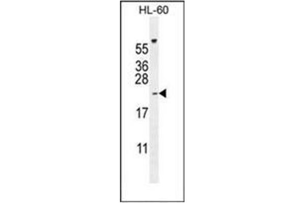 PLA2G2C 抗体  (C-Term)