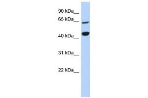 RFC4 antibody used at 1 ug/ml to detect target protein. (RFC4 抗体)