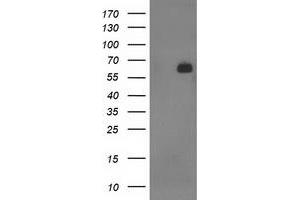 HEK293T cells were transfected with the pCMV6-ENTRY control (Left lane) or pCMV6-ENTRY SH2B3 (Right lane) cDNA for 48 hrs and lysed. (SH2B3 抗体)