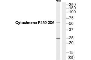 Western Blotting (WB) image for anti-Cytochrome P450, Family 2, Subfamily D, Polypeptide 6 (CYP2D6) (C-Term) antibody (ABIN1852641) (CYP2D6 抗体  (C-Term))