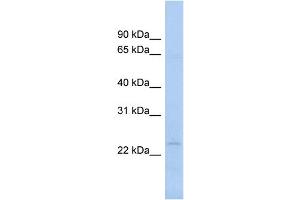 WB Suggested Anti-NAT9 Antibody Titration:  0. (NAT9 抗体  (N-Term))