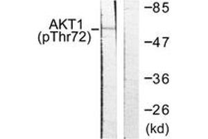 Western blot analysis of extracts from NIH-3T3 cells treated with TNF-a 20ng/ml 30', using Akt (Phospho-Thr72) Antibody. (AKT1 抗体  (pThr72))