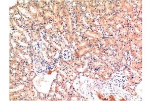 Immunohistochemical analysis of paraffin-embedded Mouse Kidney Tissue using Bax Mouse mAb diluted at 1:200. (BAX 抗体)