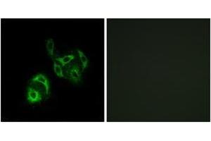 Immunofluorescence analysis of A549 cells, using SLC27A4 Antibody. (SLC27A4 抗体  (AA 61-110))