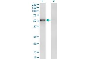 Western Blot analysis of ZNF207 expression in transfected 293T cell line by ZNF207 monoclonal antibody (M04), clone 8G7. (ZNF207 抗体  (AA 1-110))