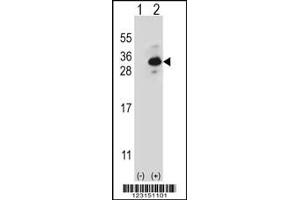 Western blot analysis of CLTB using rabbit polyclonal CLTB Antibody using 293 cell lysates (2 ug/lane) either nontransfected (Lane 1) or transiently transfected (Lane 2) with the CLTB gene. (CLTB 抗体)