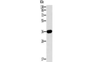 Gel: 10 % SDS-PAGE, Lysate: 40 μg, Lane: Human fetal intestine tissue, Primary antibody: ABIN7129939(ITLN1 Antibody) at dilution 1/400, Secondary antibody: Goat anti rabbit IgG at 1/8000 dilution, Exposure time: 2 minutes (ITLN1/Omentin 抗体)