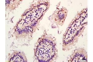 Formalin-fixed and paraffin embedded mouse intestine labeled with Anti-HSD11B1 Polyclonal Antibody, Unconjugated (ABIN750913) at 1:200 followed by conjugation to the secondary antibody and DAB staining (HSD11B1 抗体  (AA 201-292))