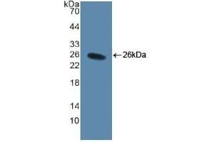 Detection of Recombinant CD40L, Human using Polyclonal Antibody to Cluster Of Differentiation 40 Ligand (CD40L) (CD40 Ligand 抗体  (AA 48-244))