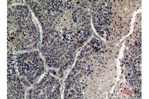 Immunohistochemistry (IHC) analysis of paraffin-embedded Human Lung, antibody was diluted at 1:100. (Histone H4 抗体  (Lys331))